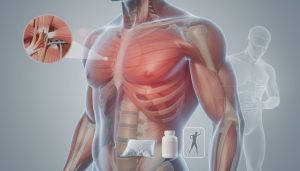 découvrez les causes, symptômes et traitements possibles de la douleur intercostale gauche pour mieux comprendre et soulager cet inconfort thoracique.